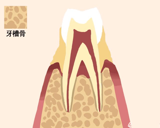 牙齿松动