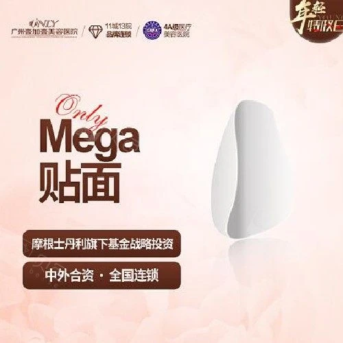 【牙齿贴片美加贴面】美加牙齿瓷贴面